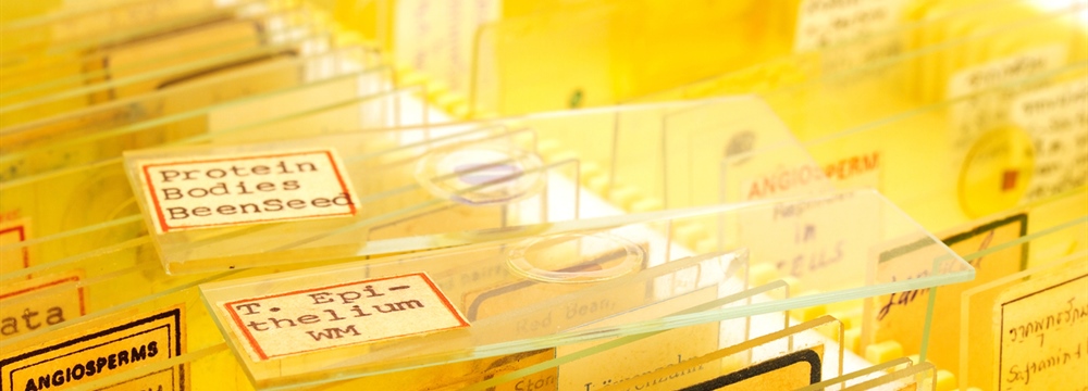 Slideshow: Fine Print Fears