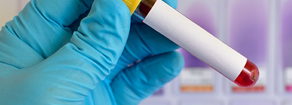 CDC Releases Interim Coding Guidance for Coronavirus