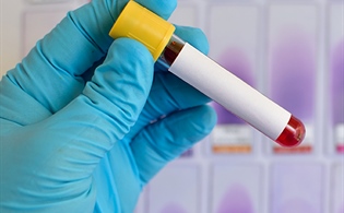 CDC Releases Interim Coding Guidance for Coronavirus