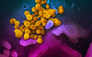 New CPT Code Announced to Report Novel Coronavirus Test